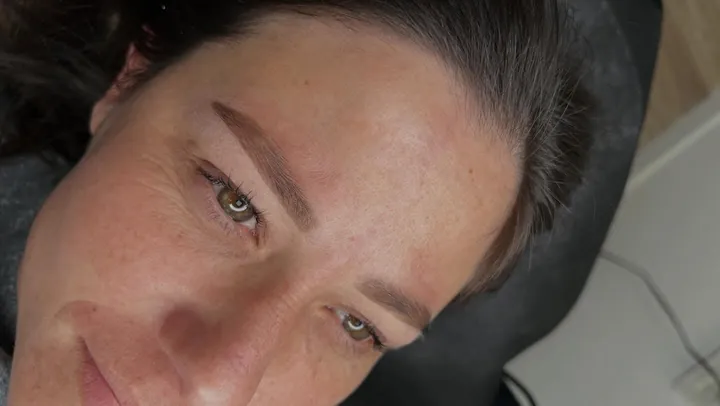 Sourcils après la restructuration