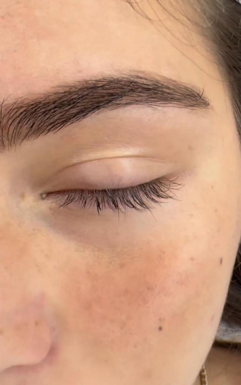 Sourcil restructuré, vu de près