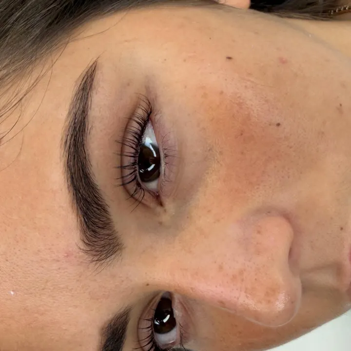 Sourcil restructuré de profil